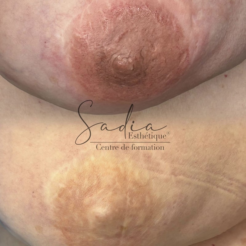 Réalisation Onglerie - 1